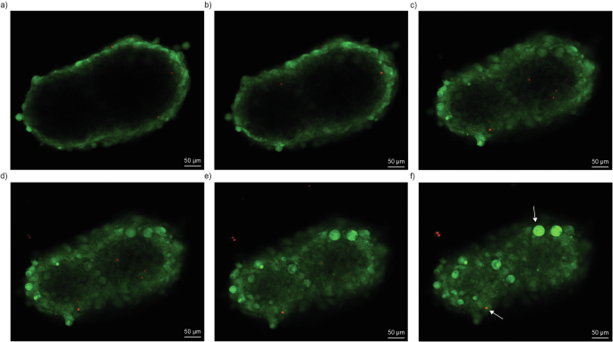 Fig. 5: Live/dead viability assay of the spheroids.