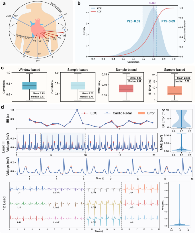 Fig. 2: Overall performance of reconstructed 12-lead ECG.