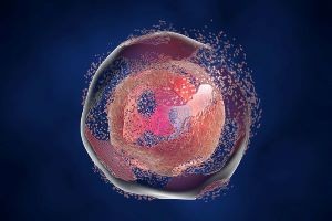 Cell death caused by lysis of the plasma membrane.