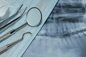 Set of medical dental equipment, dental floss and mask on x-ray