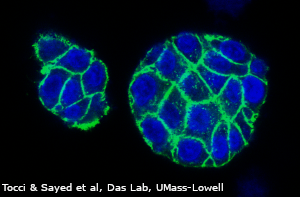3D patient-derived organoids are isolated from human colonic tissue sections to model inflammatory bowel disease. The organoids are stained with DAPI (blue) for nuclei and Phalloidin (green) for cytoskeletal structures.