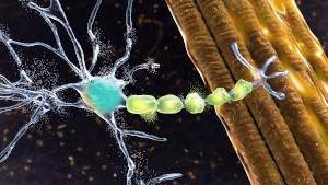 Degradation of motor neurons