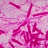Mycology research on the front line of environmental and health challenges