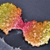 Pancreatic Cancer Awareness Month – Using computer models to understand tumor growth