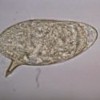 New focus on intestinal schistosomiasis: Emergence of Biomphalaria snails and transmission of Schistosoma mansoni in Lake Malawi