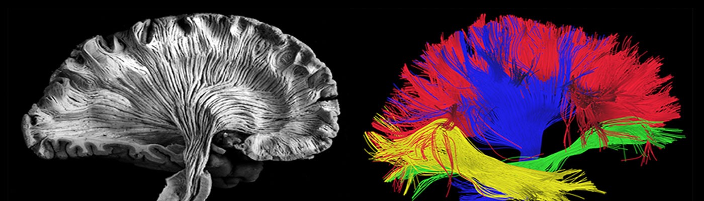 Human Brain MRI Reproducibility