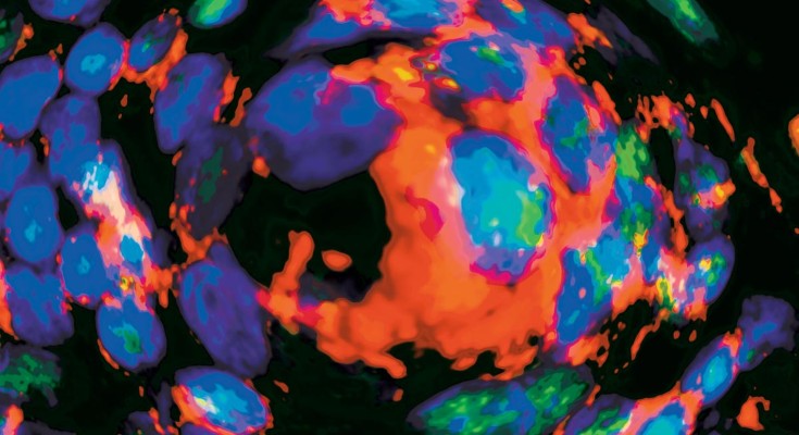 Image courtesy of Cornelia Weyand, Tuantuan Zhao, Mayo Clinic