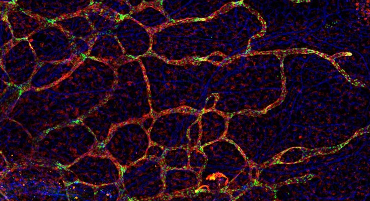 Image courtesy of Dr. Derek Sung, University of Pennsylvania
