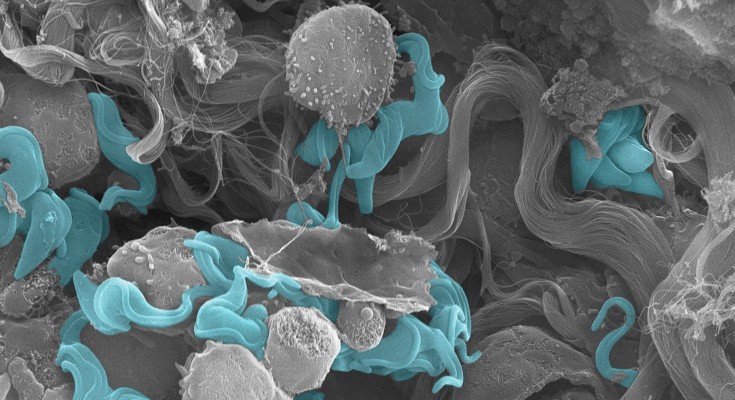 Microscopic image of parasites in lung tissue