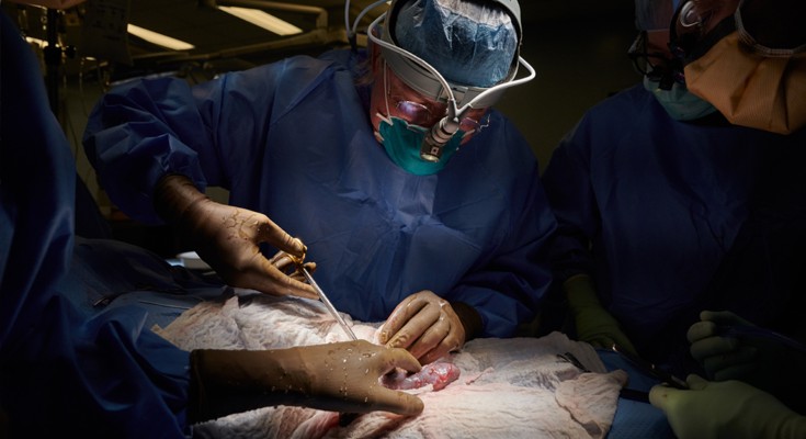 Three medical professionals in blue scrubs and face masks in an operating theatre, including a surgeon in the middle of the image who is working to transplant a kidney into a legally dead patient