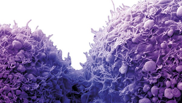 Nutrition for Diabetes: Nutritional Approaches for the Treatment of Diabetes