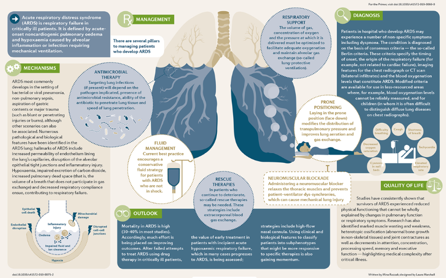 Acute respiratory distress syndrome