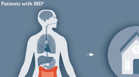 Figure: IBD during COVID-19