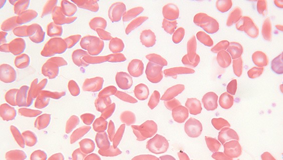 T_056Q3_SDG-2025_SDG3_600x340px_G154329065