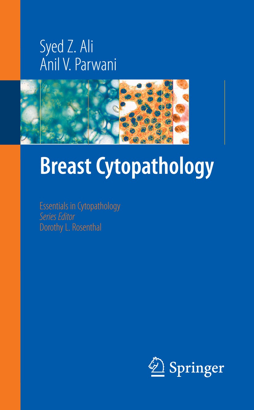 Breast Cytopathology | Springer Nature Link (formerly SpringerLink)