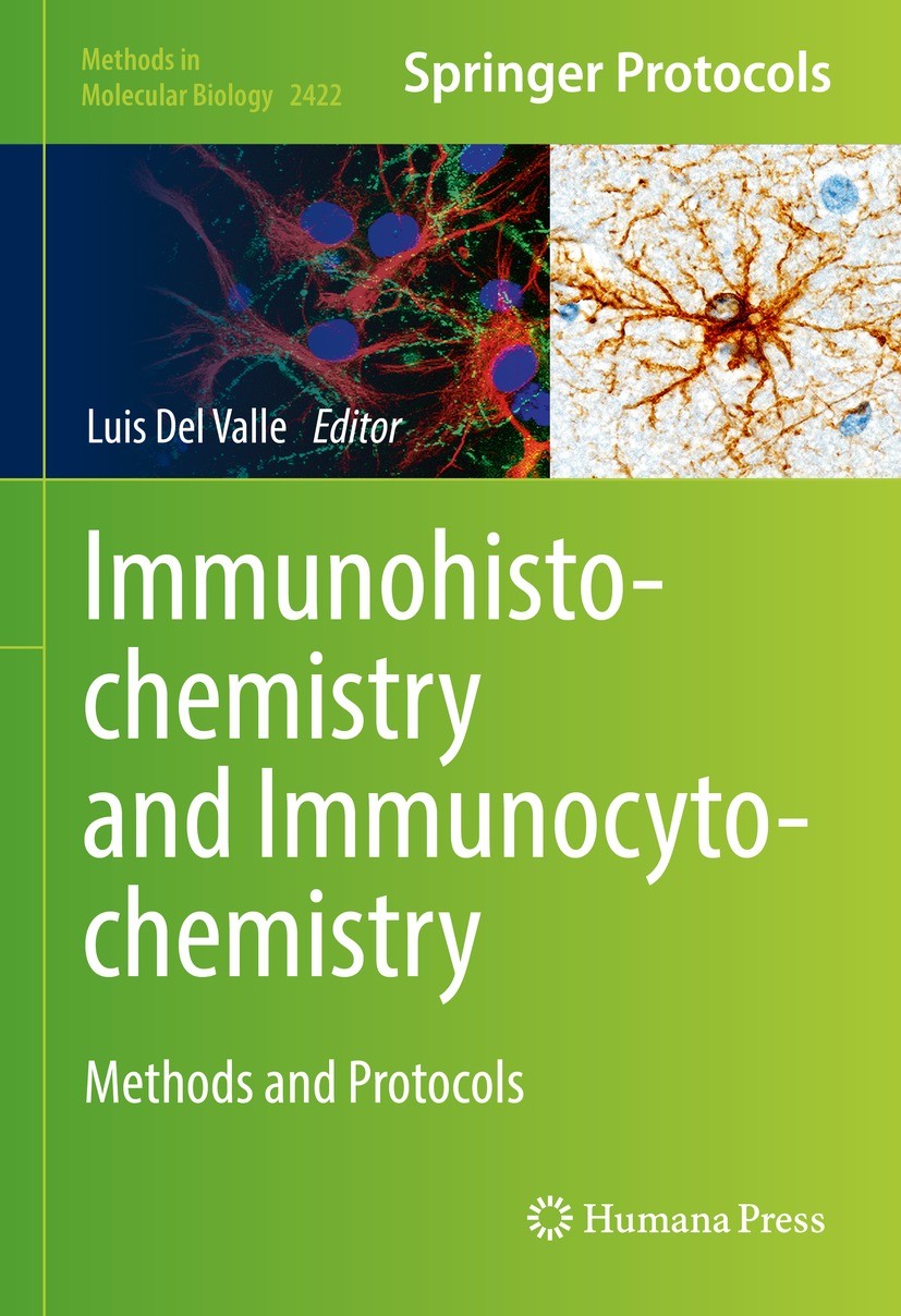 Immunohistochemistry and Immunocytochemistry: Methods and