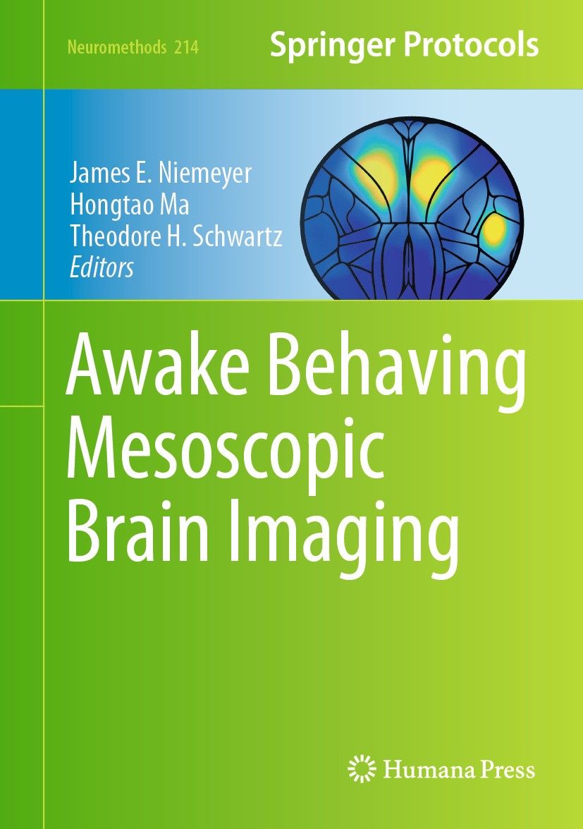 脳機能入門 = A Glimpse of Brain Functions : 脳機能 入門: 機能局在から症状・リハビリまで／実際の症状が