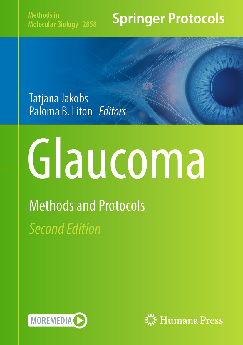 Glaucoma: Methods and Protocols | SpringerLink