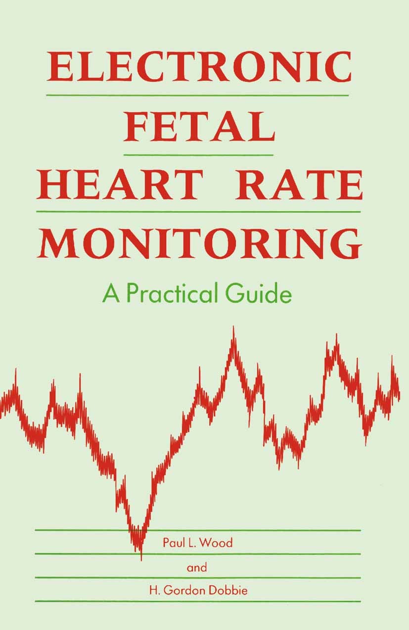 Electronic Fetal Heart Rate Monitoring: A Practical Guide
