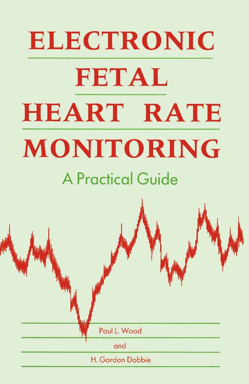Fetal heart rate monitoring