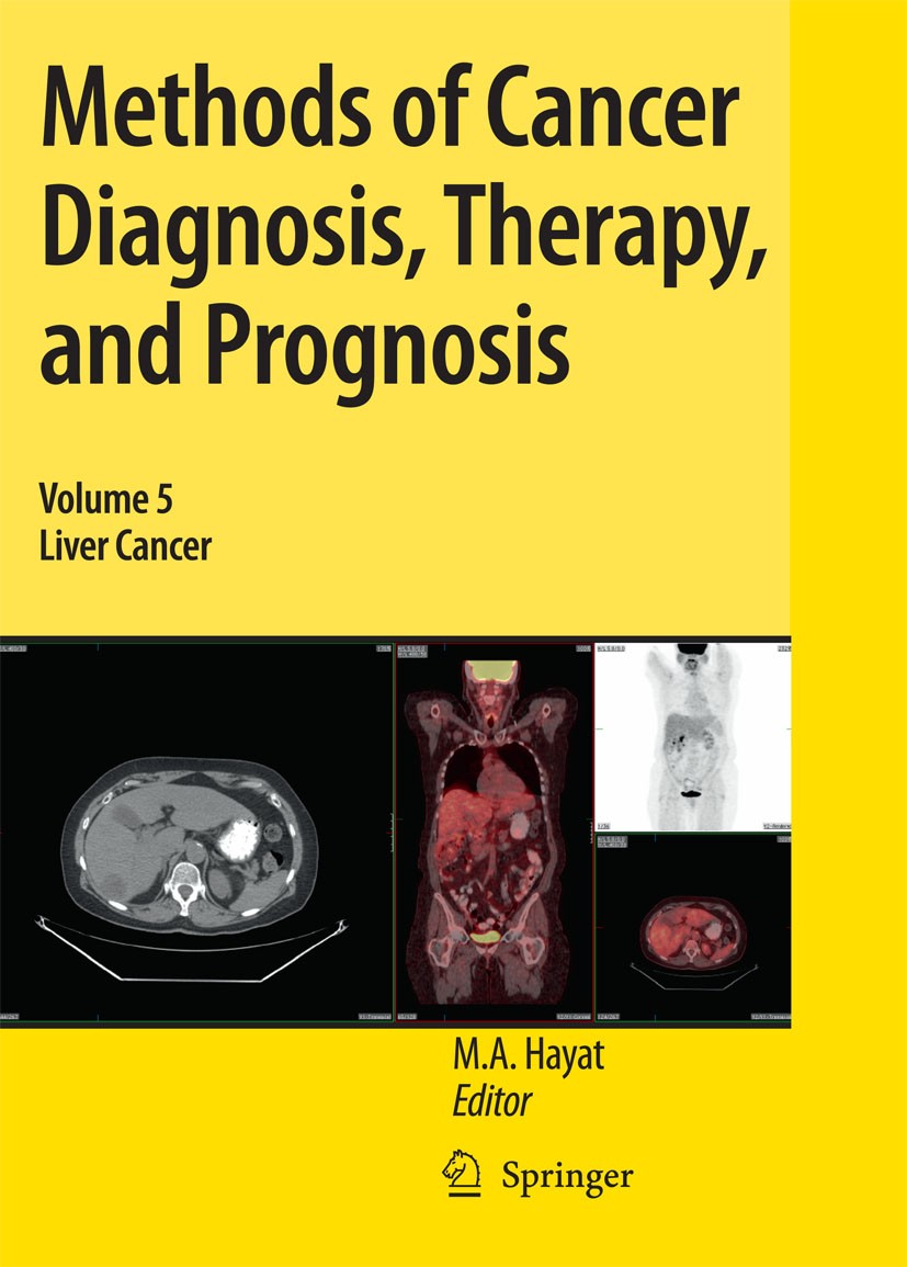 Ｔｈｅ　ＬＩＶＥＲ　ＣＡＮＣＥＲ　ＪＯＵＲＮＡＬ ７-１/メディカルレビュ-社/「Ｔｈｅ　Ｌｉｖｅｒ　Ｃａｎｃｅｒ　Ｊｏ（単行本） Cancer stemness in hepatocellular carcinoma: mechanisms and