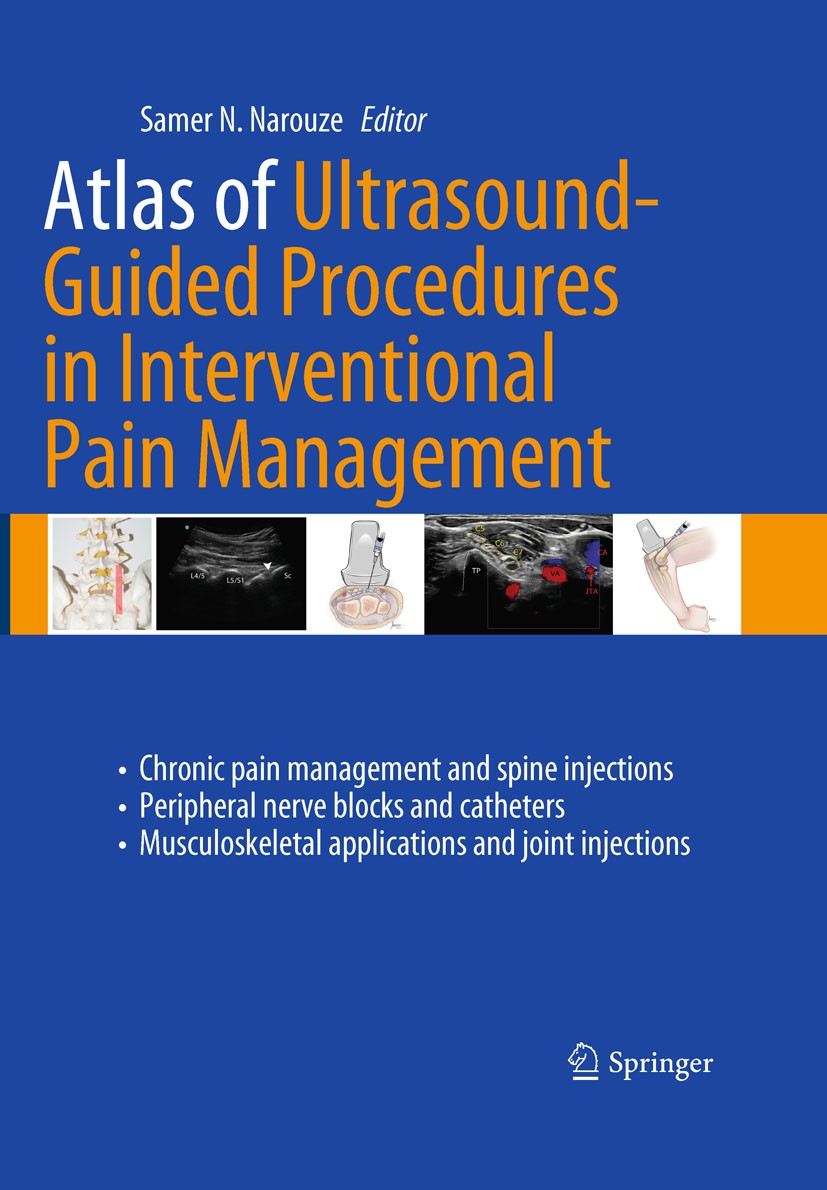 Interventional Pain Management for Abdominal Pain