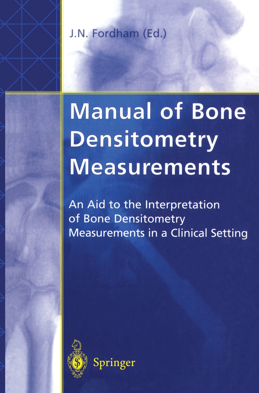 Use of Bone Mineral Density Measurement in Orthopaedic Practice |  SpringerLink