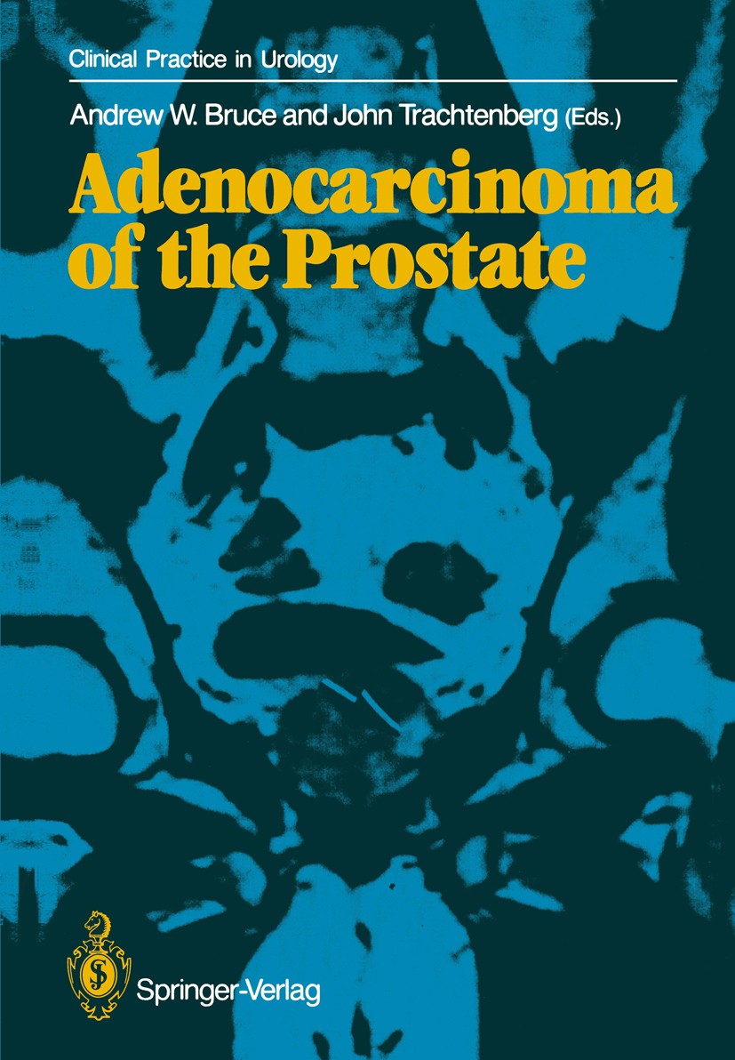 AFIP4th #14 Tumors of the Prostate(新本) Tumors of the Prostate Gland, Seminal Vesicles, and Scrotum