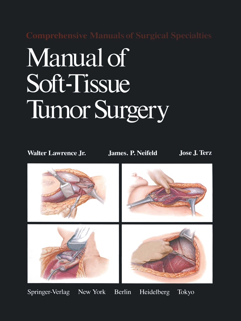 Manual of Soft-Tissue Tumor Surgery | SpringerLink