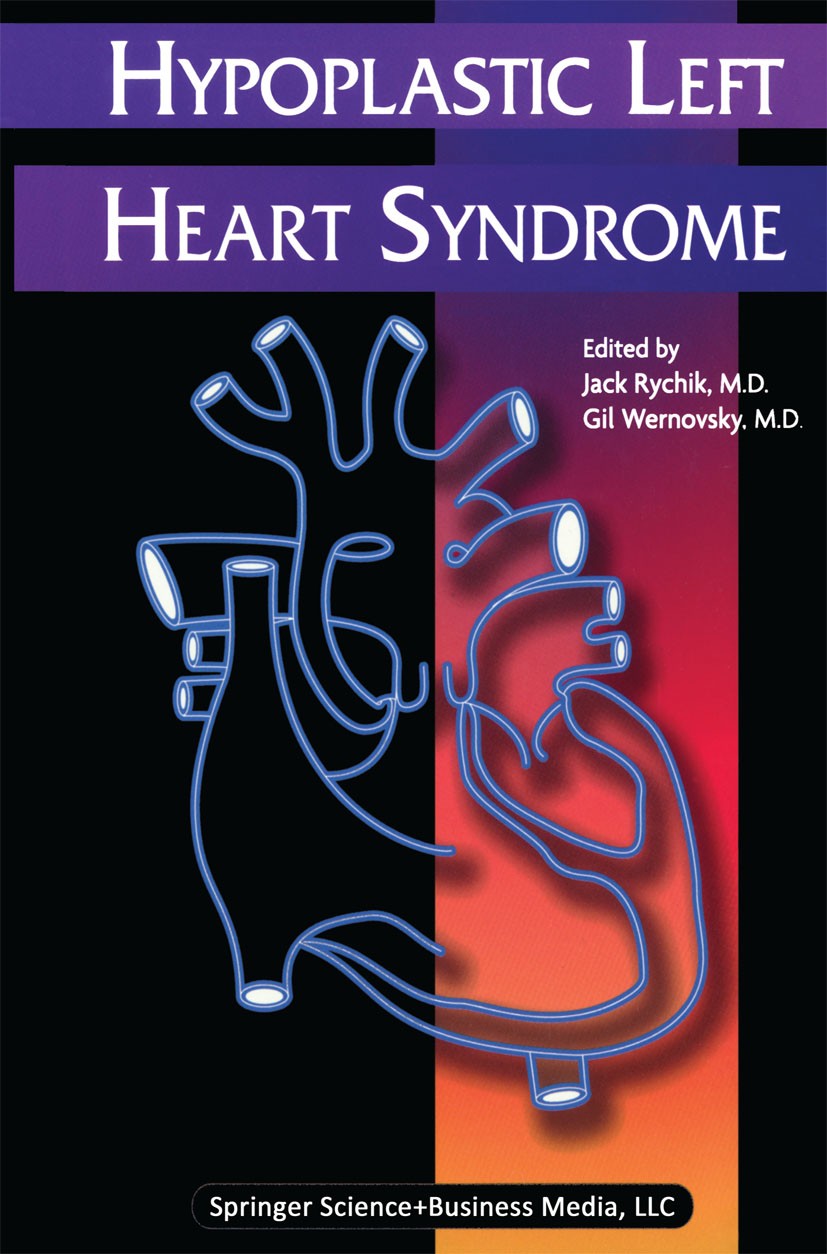 Hypoplastic Left Heart Syndrome | SpringerLink