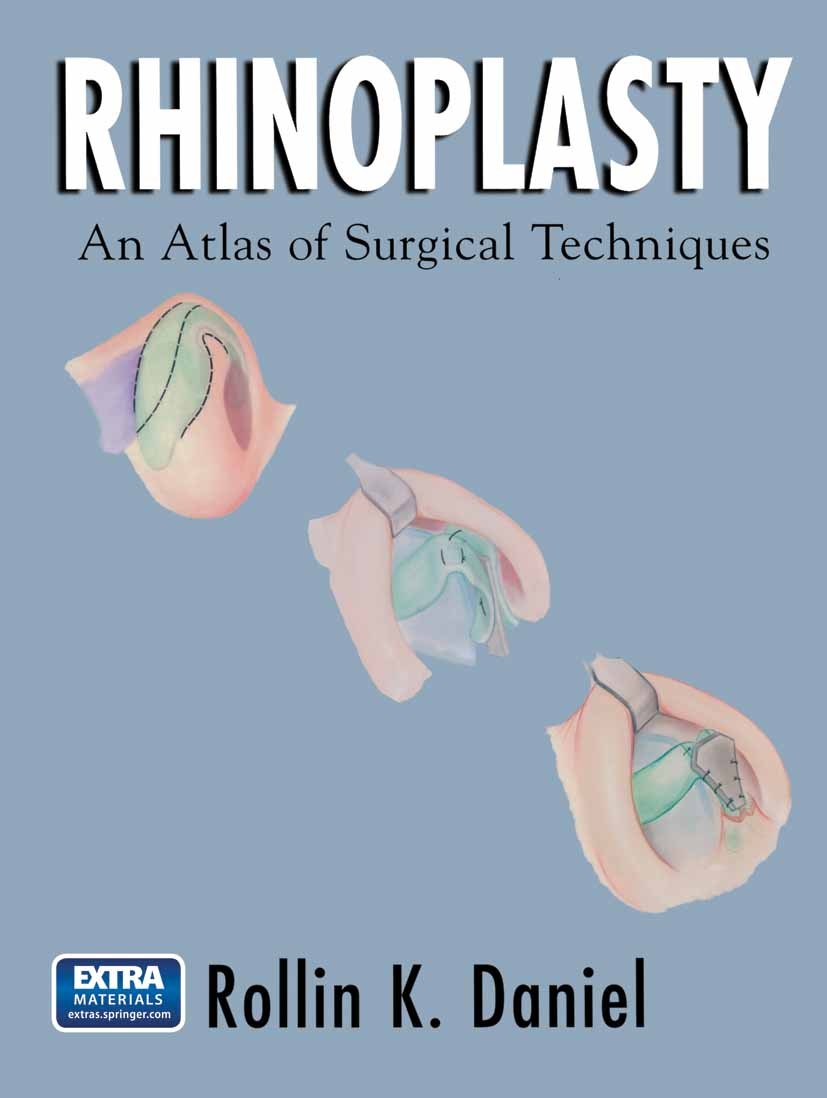 Rhinoplasty: An Atlas of Surgical Techniques | SpringerLink