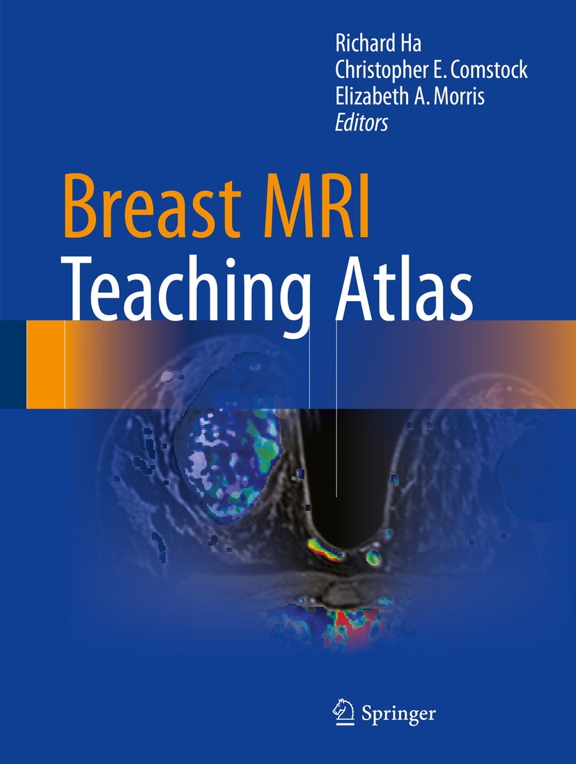 健康・医学 Atlas of Breast Surgical Techniques Atlas of breast surgical techniques - Journal of Plastic