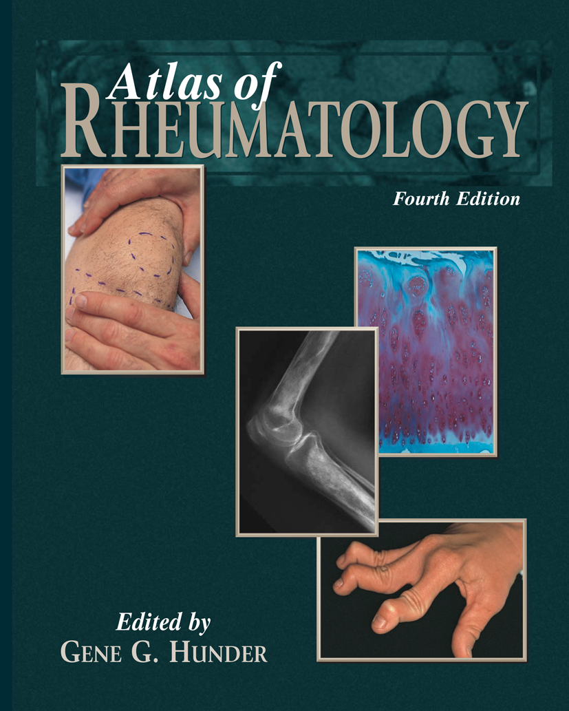 Atlas of Rheumatology | SpringerLink