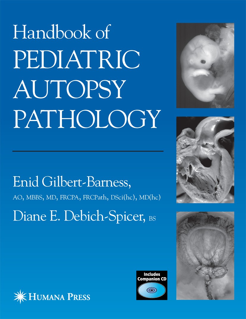 autupsy Handbook of Pediatric Autopsy Pathology | SpringerLink