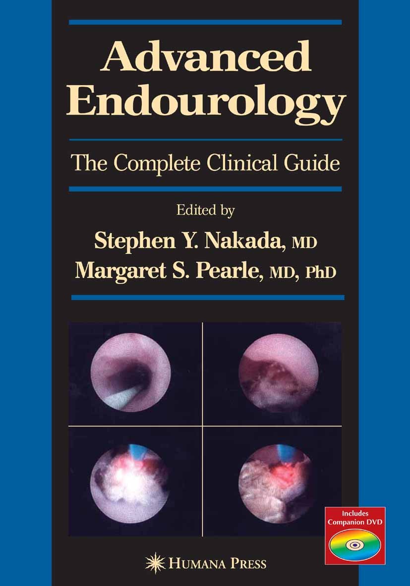 Advanced Endourology: The Complete Clinical Guide | SpringerLink