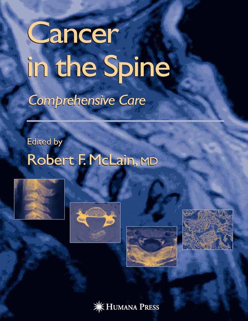 【2024新春福袋】 in Cancer the SpringerLink | Care Comprehensive Spine: 洋書