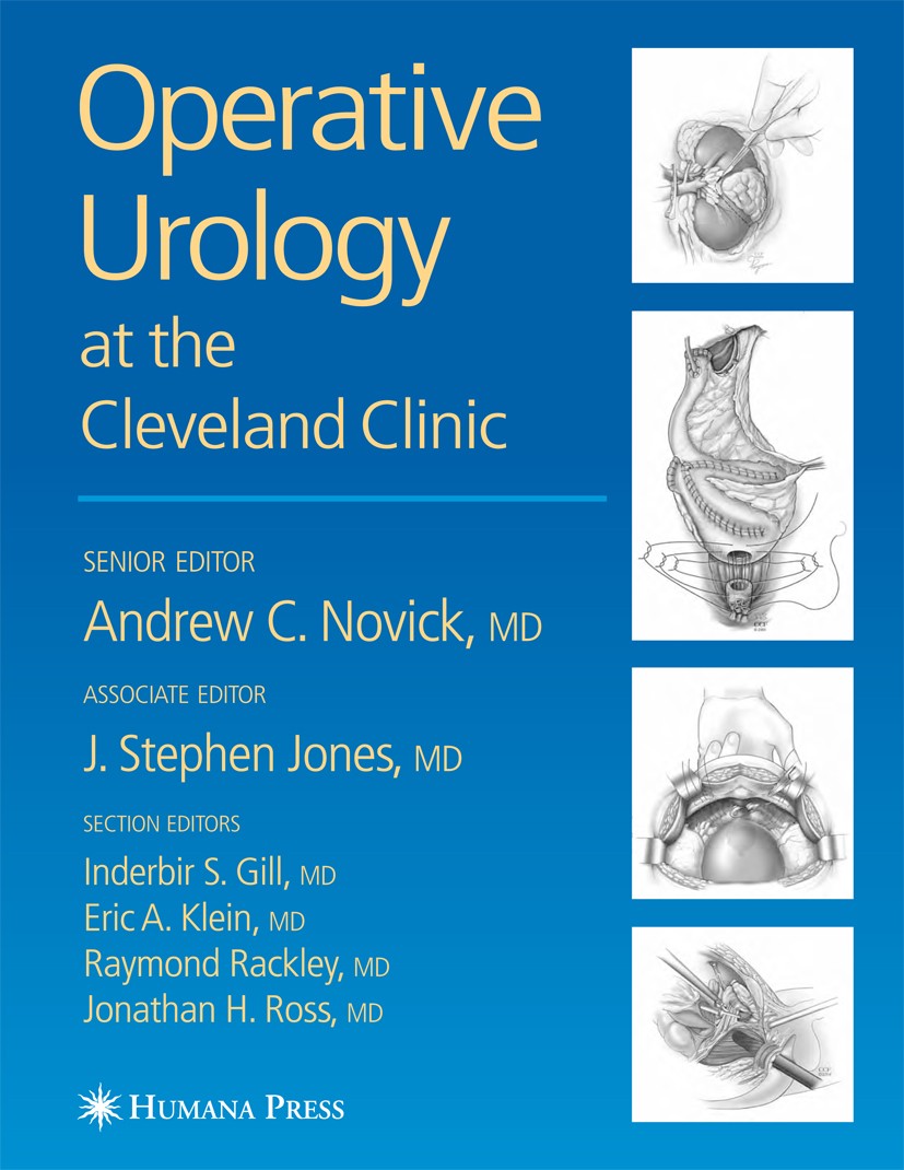 Operative Urology | SpringerLink