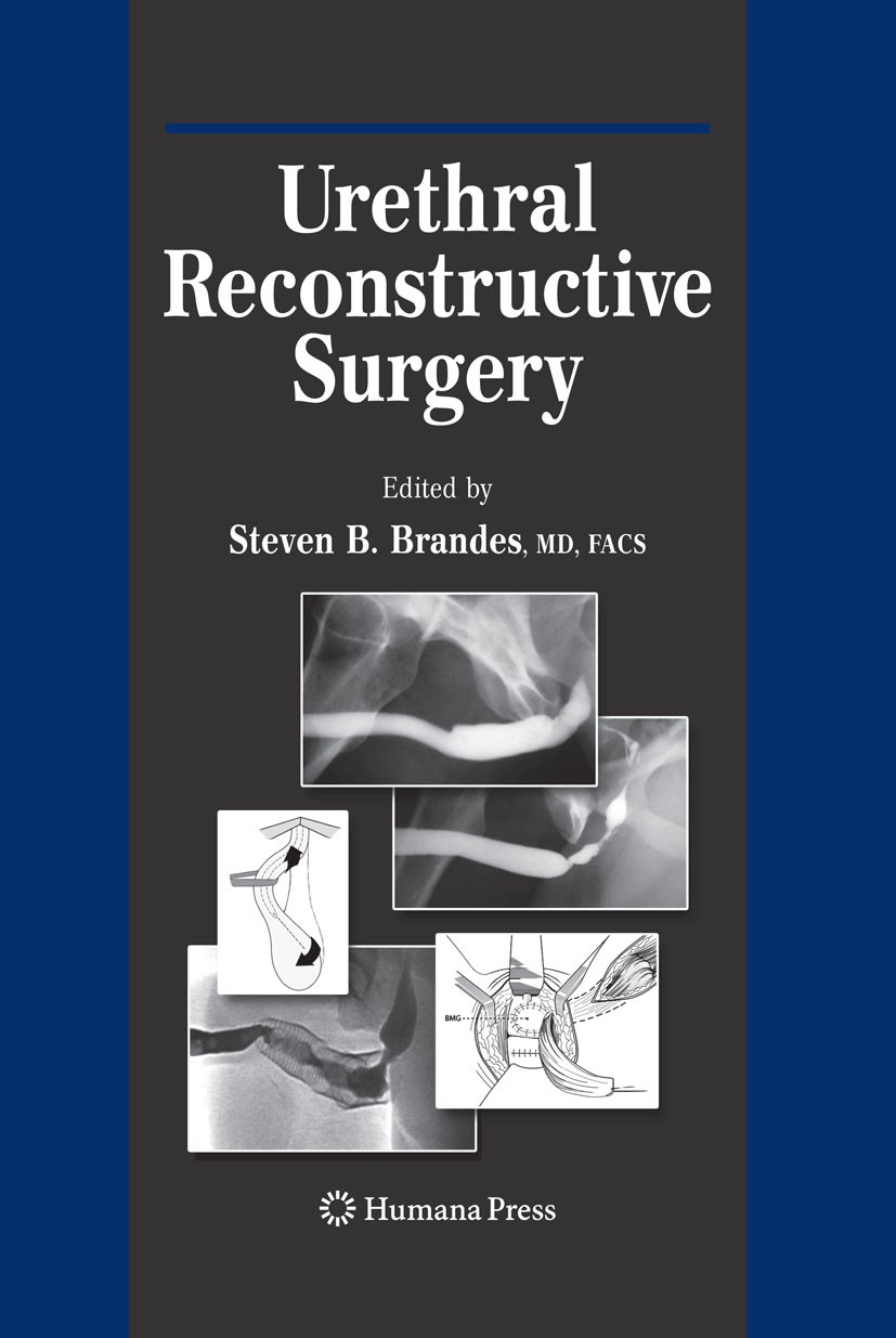 Urethral Reconstructive Surgery | SpringerLink