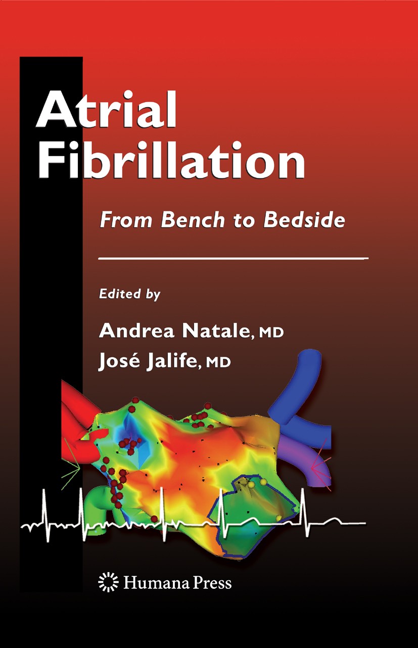 ●01)【同梱不可】心房細動の外科的治療/Surgical Treatment of Atrial Fibrillation/Jonathan Philpott/Academic Press/洋書/医学/医療/A ○01)【同梱不可】心房細動の外科的治療/Surgical Treatment of