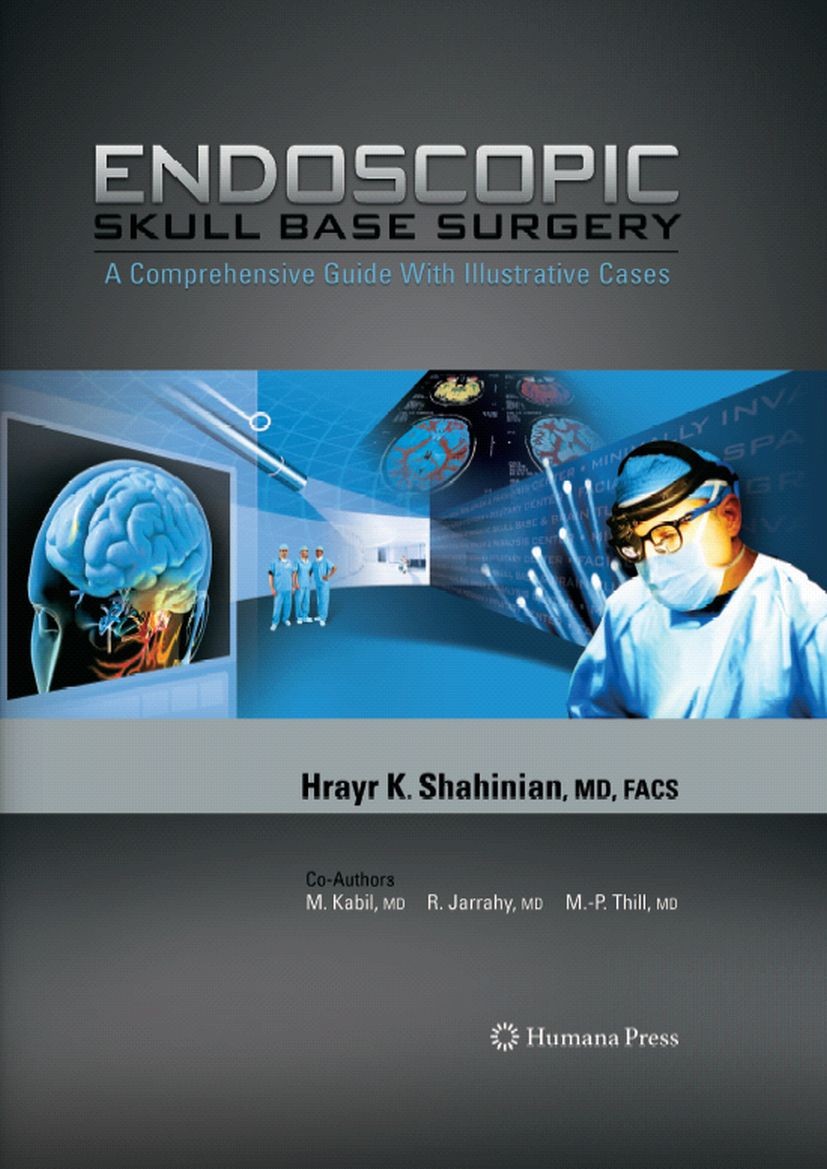 Endoscopic Skull Base Surgery: A Comprehensive Guide with