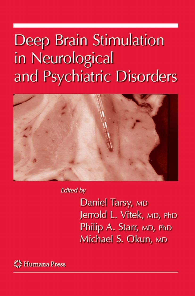 and　Deep　Neurological　in　Brain　Stimulation　SpringerLink　Psychiatric　Disorders