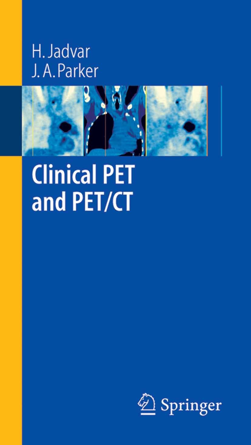 PET-CT画像診断マニュアル Clinical PET and PET/CT | SpringerLink