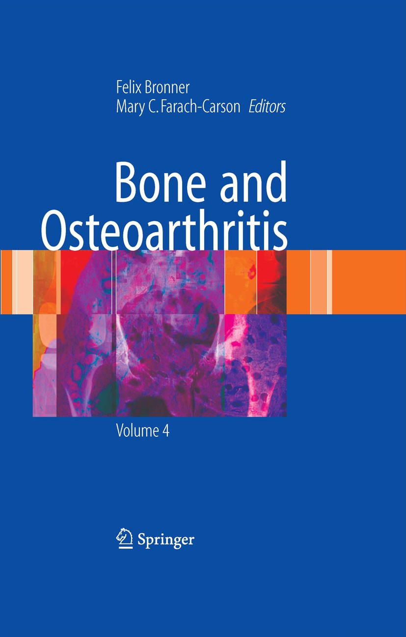 The Pathogenesis of Osteoarthritis | SpringerLink