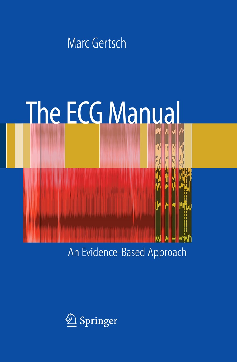 The ECG Manual: An Evidence-Based Approach | SpringerLink The ECG Manual: An Evidence-Based Approach | SpringerLink