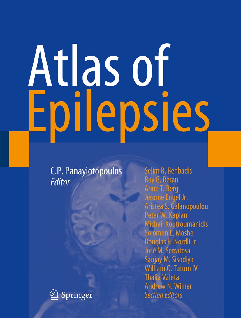 Atlas of Epilepsies | SpringerLink