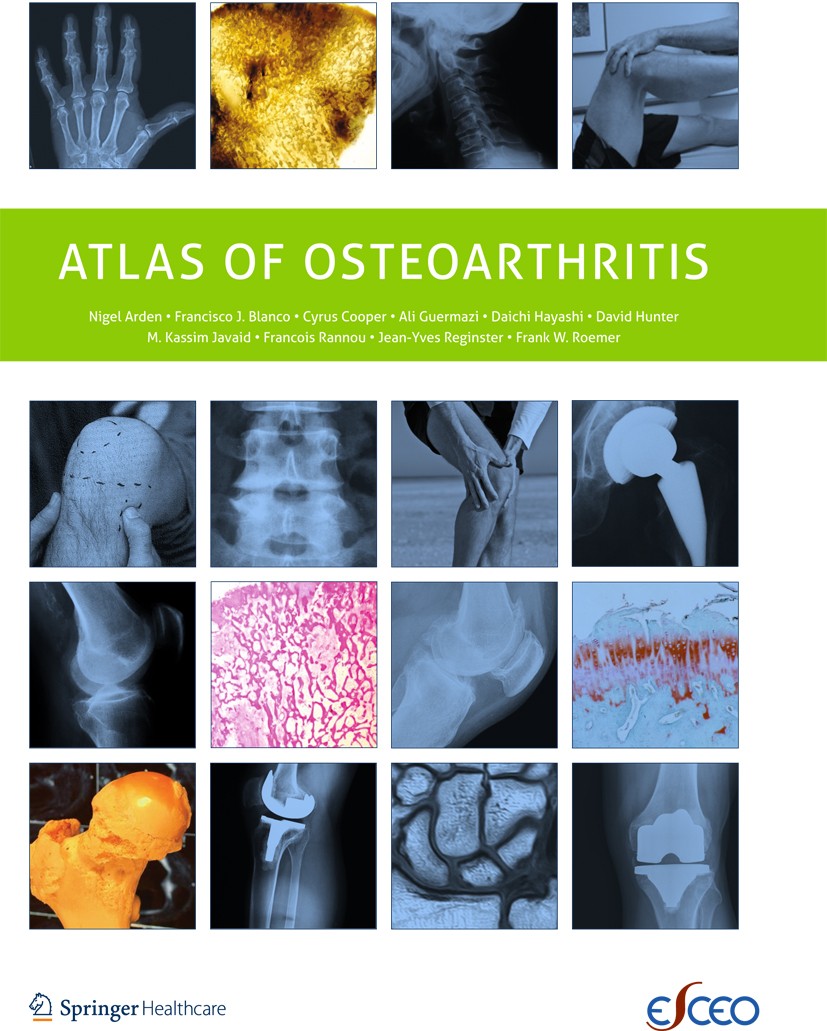 Osteoarthritis, Rheumatisms, Arthritis: Natural Solutions Which Will Change Your Life [Book]