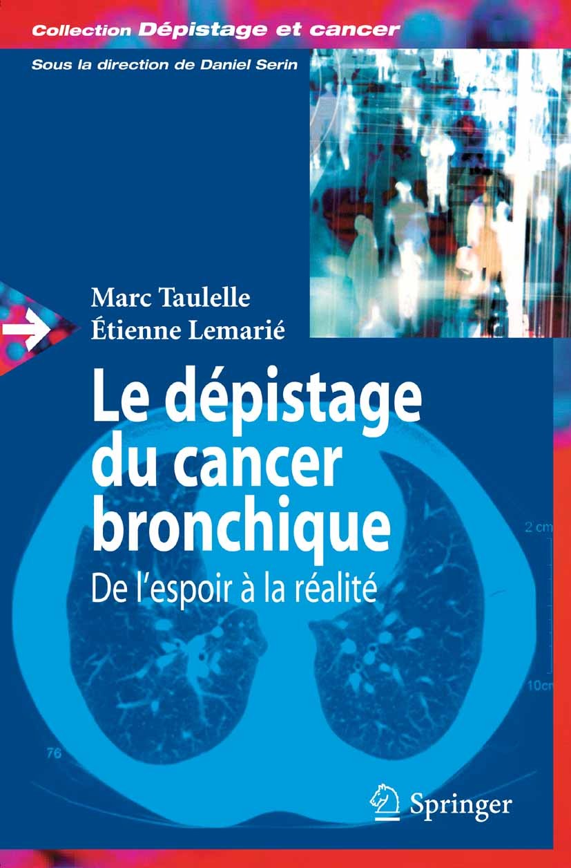 Conduite A Tenir Devant Un Nodule Pulmonaire De Decouverte Fortuite Springerlink