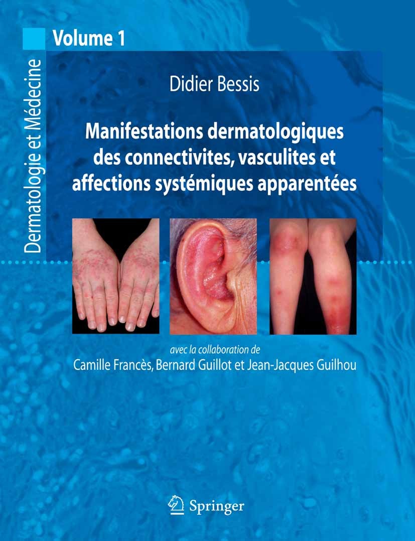 Manifestations dermatologiques des connectivites, vasculites et ...