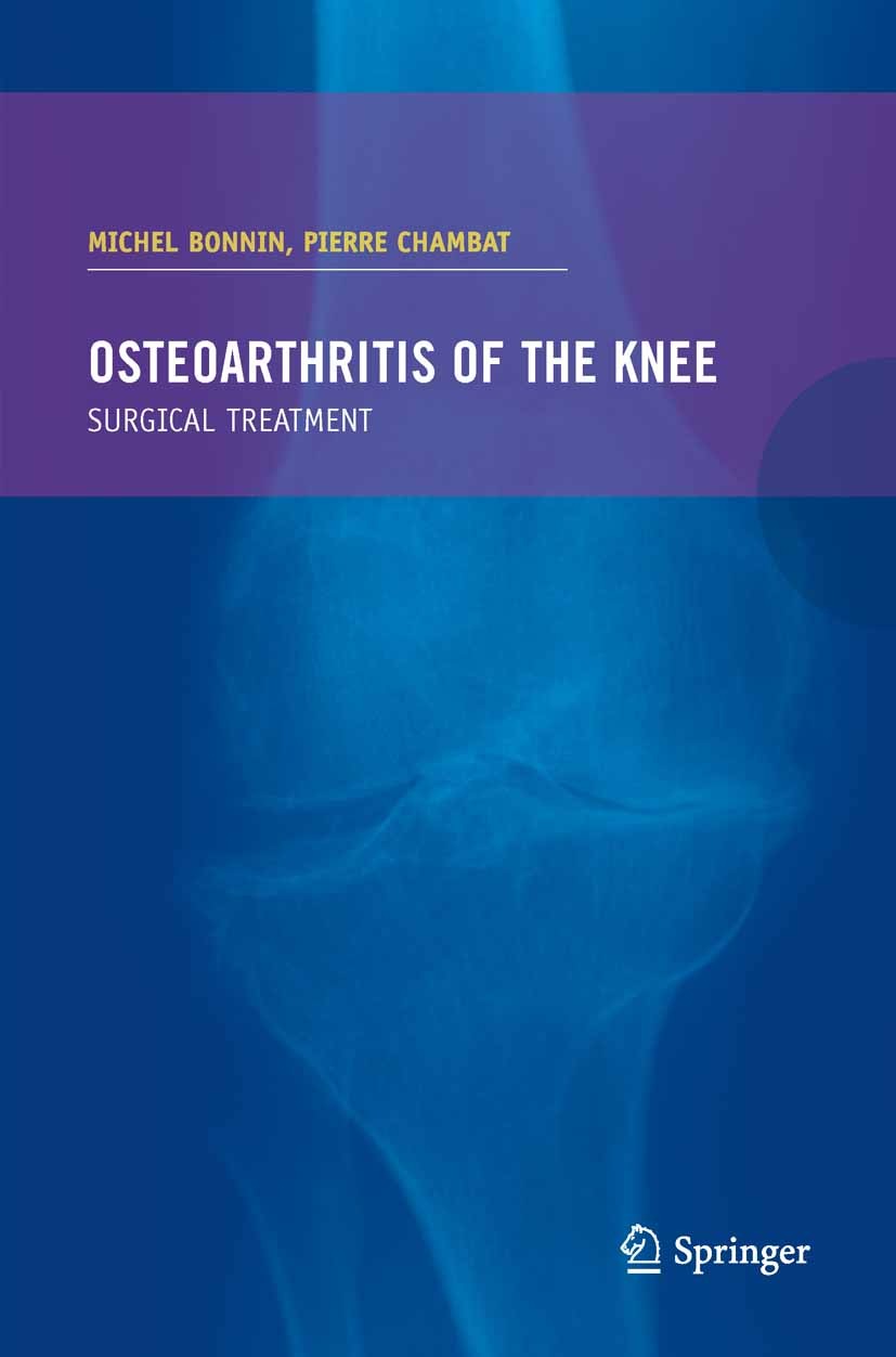 Patellofemoral Osteoarthritis Springerlink