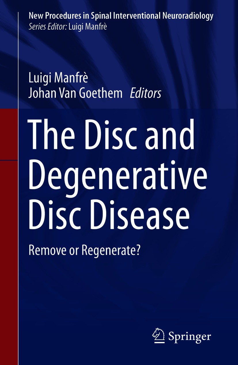 The Disc and Degenerative Disc Disease: Remove or Regenerate? | SpringerLink The Disc and Degenerative Disc Disease: Remove or Regenerate? | SpringerLink